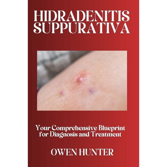 Hidradenitis Suppurativa: Your Comprehensive Blueprint for Diagnosis and Treatment, (Paperback)