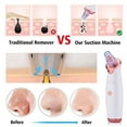 thumbnail image 5 of N1 Electric Blackhead Remover Pore Vacuum Suction Dermabrasion Face Cleaner, 5 of 11
