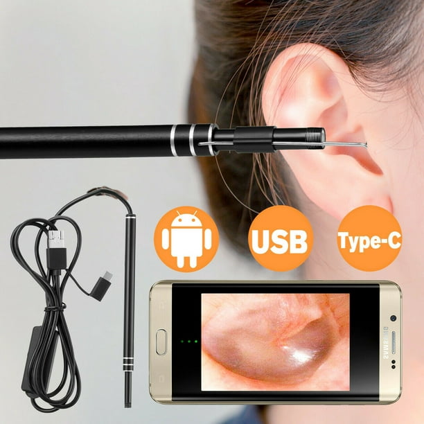 W1 outil de retrait de cérumen caméra WiFi Kit de nettoyage d'oreille  cure-oreille avec lumière LED-Blanc