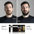 thumbnail image 5 of Beard Grooming Kit - Beard Growth Kit with Beard Oil Growth, Beard Balm, Beard Comb, Beard Brush, Beard Kit Mens Gifts for Birthday Husband Boyfriend Dad Brother, 5 of 9
