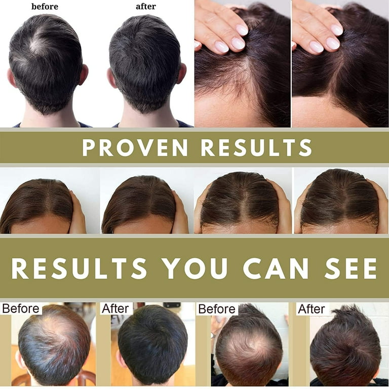 Hair growth scalp treatment discount