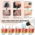 thumbnail image 7 of INSMART Electric Blackhead Remover - Pore Vacuum Cleaner with Heating Mode, 3 Suction Levels & 5 Attachments, Facial Comedone Extractor Kit for Deep Cleansing, 7 of 7