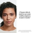 thumbnail image 6 of Neutrogena Evenly Clear Retinoid, Adapalene Gel 0.1%, 0.5 oz, 6 of 13