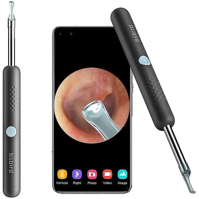 Recolector de orejas otoscopio endoscopio de eliminación de cera de oído negro/blanco