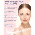 thumbnail image 4 of Face Wash e70 Rosacea Solve Hydrating 240mL w/ Aloe Vera, 4 of 8