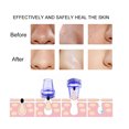 thumbnail image 3 of Blackhead Remover Vacuum Creative 5 in 1 Electric Pore Cleaner Blackhead Cleaner, 3 of 7