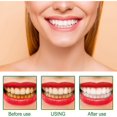 thumbnail image 4 of New- Eelhoe Toothbrush Oral Decontamination Cleaning Remove Yellow Teeth Tooth Staining Brightening Whitening Teeth Care, 4 of 5
