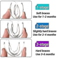 thumbnail image 2 of Orthodontic Teeth Corrector Silicone Braces Retainer Straighten Tools Teeth Capped for Adults, 2 of 5