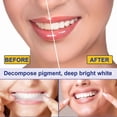 thumbnail image 2 of Teeth Whitening Strips 7pcs, Helps Remove Smoking /Coffee/Soda/Wine Stain, 2 of 5