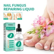NATUREASY Extra Strength Toenail Fungus Treatment For Toenail Or Fingernail, Nail Repair Solution, Nail Renewal Liquid For Damaged & Discoloration Nail(1oz), 1PC