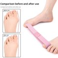 thumbnail image 2 of Elasticity Exercise with Big Toe Bone Correction Trainingpulling, 2 of 8
