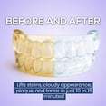 thumbnail image 4 of Tabletas limpiadoras Retainer Venus Visage Dental 120 unidades, 4 of 7