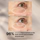 thumbnail image 5 of StriVectin Peptight 360˚ Tightening Eye Serum, 1 fl. Oz, 5 of 10