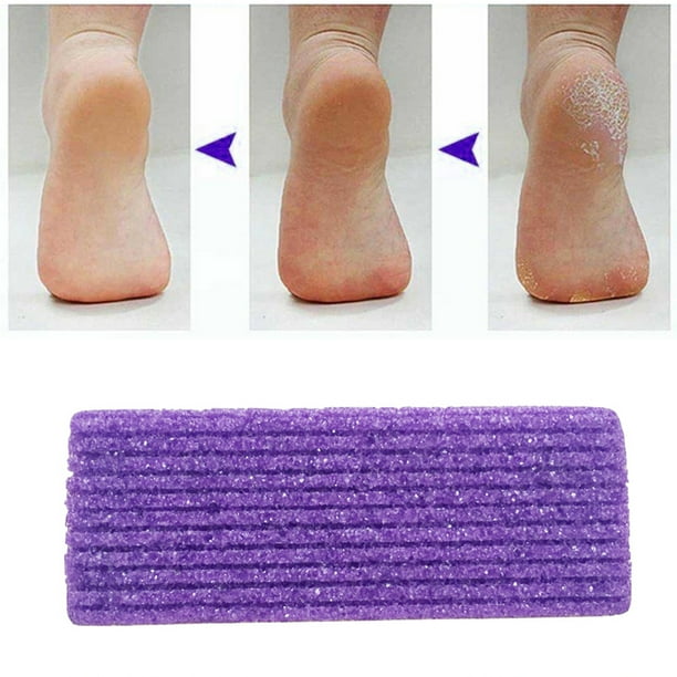 Piedra pómez 2 en 1 para pies, removedor de callos y piel dura, herramientas de pedicura para pies