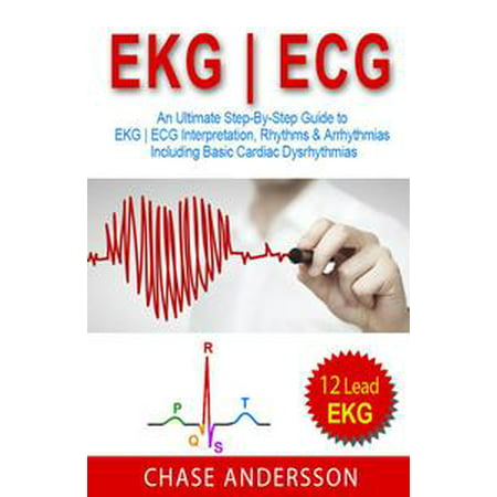 EKG | ECG: An Ultimate Step-By-Step Guide to 12-Lead EKG | ECG Interpretation, Rhythms & Arrhythmias Including Basic Cardiac Dysrhythmias -