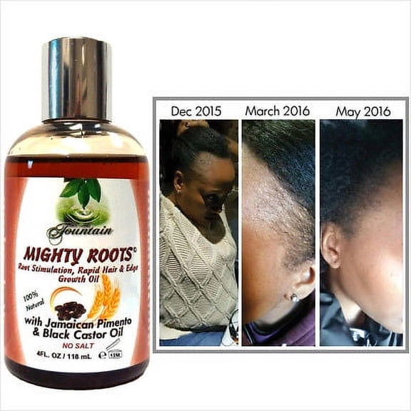 Fountain Mighty Roots Receding Hairline & Edge Growth Oil 4 oz.