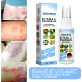 Ringworm Cream Treats Stubborn Ringworm Infections, Fights Ringworm