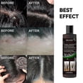 thumbnail image 3 of Nuevo champú anticaspa 2023 para el tratamiento de la picazón, aceite de control, champú limpiador refrescante anticaída, champú para el cuero cabelludo descamado, psoriasis capilar Changzhao | 65, 3 of 5
