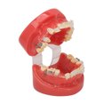 thumbnail image 1 of Modelo de Ortodoncia Soporte de Cerámica de Alambre de Metal ANGGREK 24 Dientes, 1 of 7