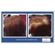 thumbnail image 5 of Alpecin Champú Tuning 200 ml, 5 of 5