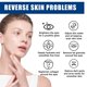 thumbnail image 4 of Fiudx Crema de Ojos de Jazmín, Fórmula Nutritiva con Proteína y Aloe, Ungüento Refrescante de Jazmín, Solución para Ojeras, Ruthina Diaria de La Piel, Apta para Todo Tipo de Piel, Duración de Tres Me, 4 of 7