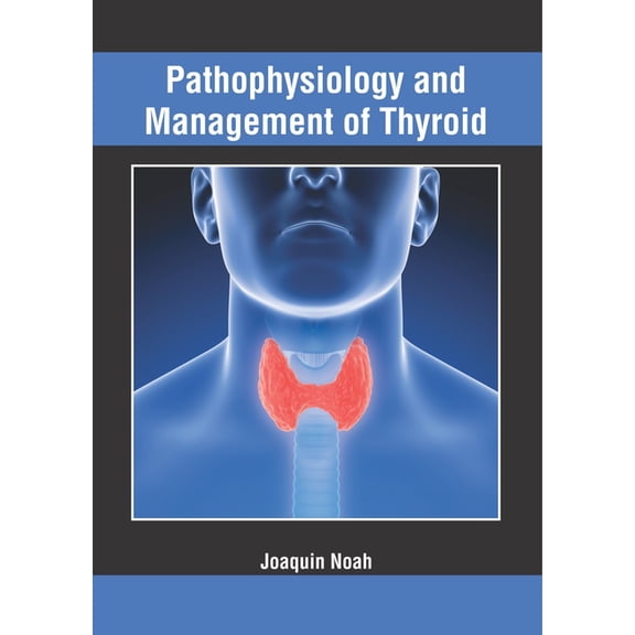 Pathophysiology and Management of Thyroid, (Hardcover)