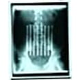 thumbnail image 5 of Mueller Back Brace/Lumbar Support -#250 - White, 5 of 5
