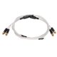 thumbnail image 1 of eboxer-1 Audiophiles Cable RCA, Cable Auxiliar de Audio 2RCA Macho a 2RCA Macho con Cable de Tierra para Fonógrafo de Vinilo LP, Audio en Casa o Experiencia de Cine en Casa, Etc.(2M) EOTVIA No, 1 of 6