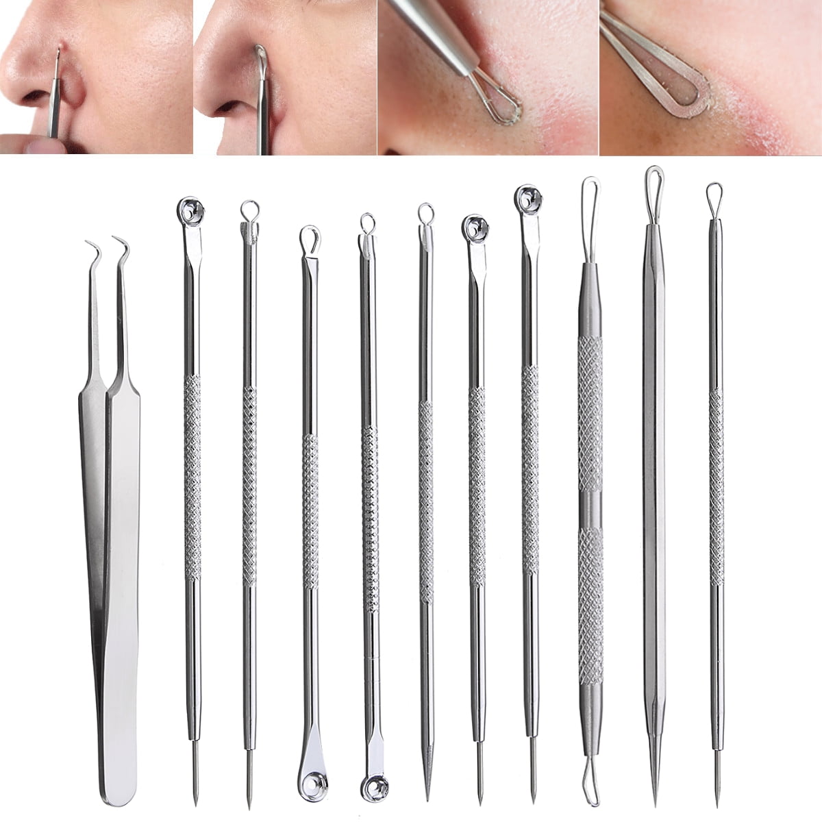 Stainless Steel Blackhead/Whitehead Pimple Blemish Face Acne Comedone