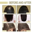 thumbnail image 3 of Natural Hair Growth oil, organic Veganic Natural Hair Growth oil,Pure Natural Hair Density Essential Oil, Plant Extract Hair Growth Oil for Dry Damaged Hair and Growth (1pcs), 3 of 7