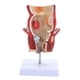 thumbnail image 4 of Modelo rectal de patología humana, herramienta de visualización educativa científica, herramienta intuitiva y didáctica, modelo anatómico para, 4 of 9