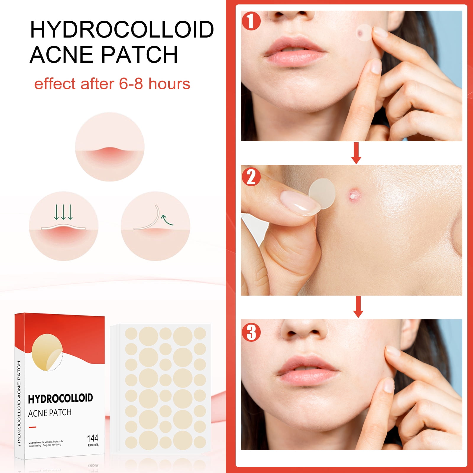 Alvantor Pimple Patches for Face, Day/Nighttime Hydrocolloid Acne Patches, 144 Count