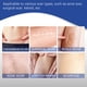 thumbnail image 5 of Parche para Heridas Quemadas Ygjytge Gel Silicona 4 Uds Accesorios Multifuncionales, 5 of 9