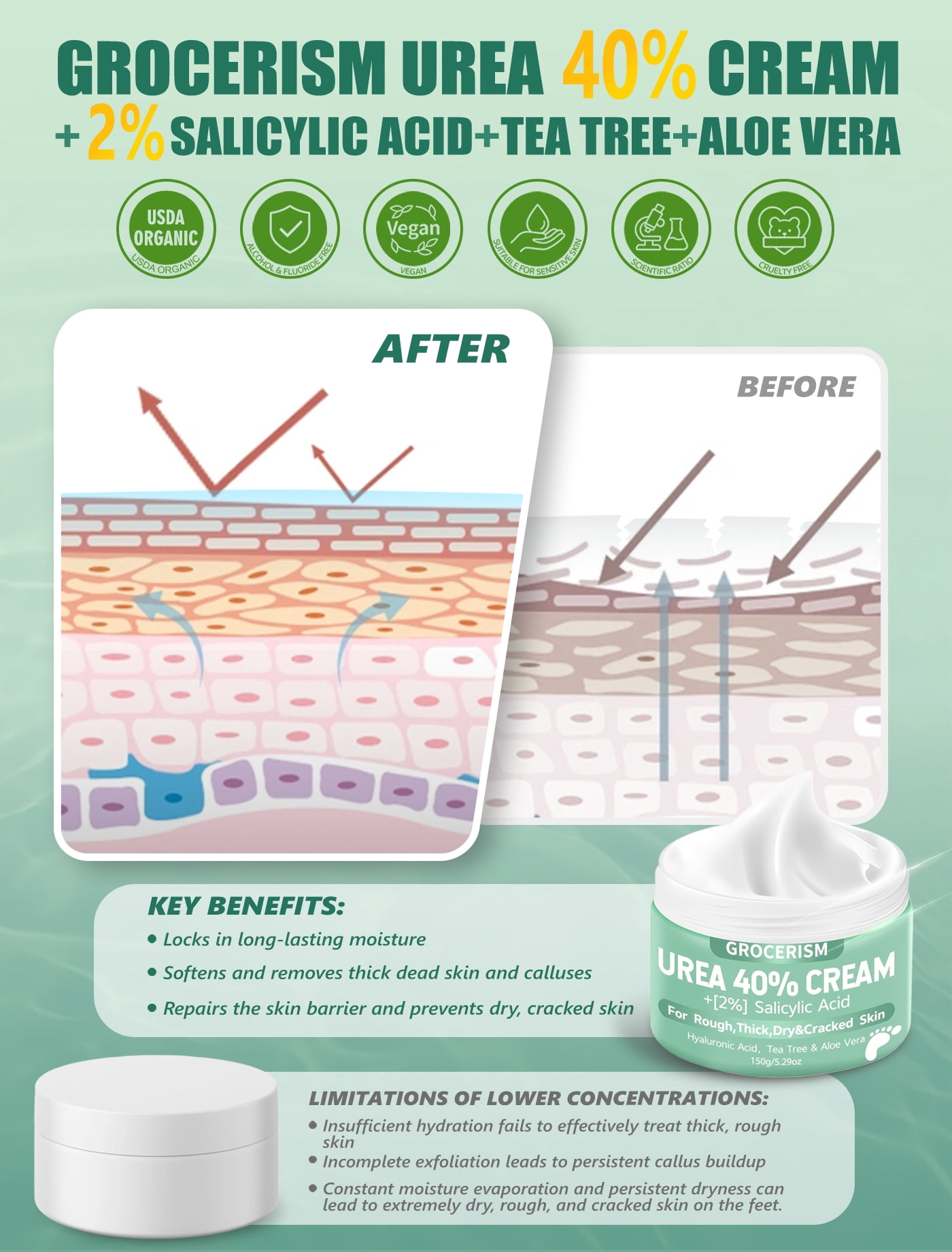 Urea Cream 40 Percent for Feet Plus Salicylic Acid 5.29 oz Foot Cream, with Hyaluronic Acid, Tea Tree,and Aloe Vera for Deep Moisturizes
