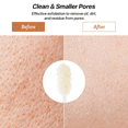 thumbnail image 2 of SUPTREE Loofah Back Scrubber Exfoliating Bath Sponge Long Handle Bath Brush for Body Shower White 1pc, 2 of 7