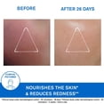 thumbnail image 4 of Crema Facial Uriage Xémose 40ml, 4 of 7