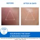 thumbnail image 4 of Crema Facial Uriage Xémose 40ml, 4 of 7