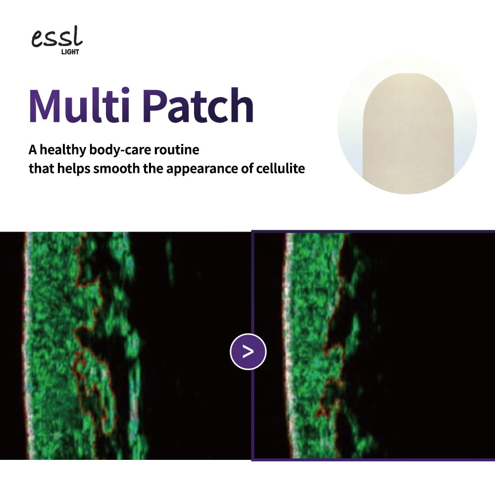 essl LIGHT Multi Patch, 10ea
