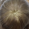 thumbnail image 5 of LYRICAL HAIR Toupee for Men Indian Human Hair Replacement System All Lace Mens Toupee French Lace Hairpieces for Man Bleached Front Knots Mens Hair Piece Unit, 5 of 7