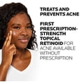 thumbnail image 4 of Gel de tratamiento del acné La Roche-Posay Effaclar Adapalene al 0,1% La Roche-Posay La Roche-Posay, 4 of 4