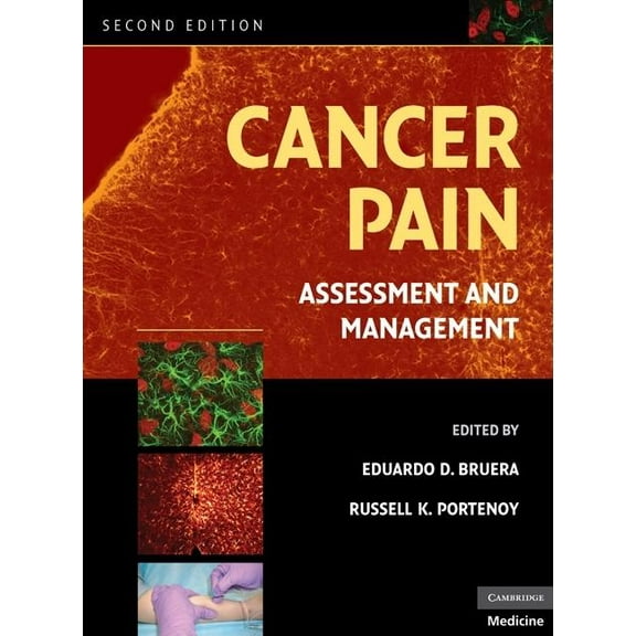 Cancer Pain, (Hardcover)