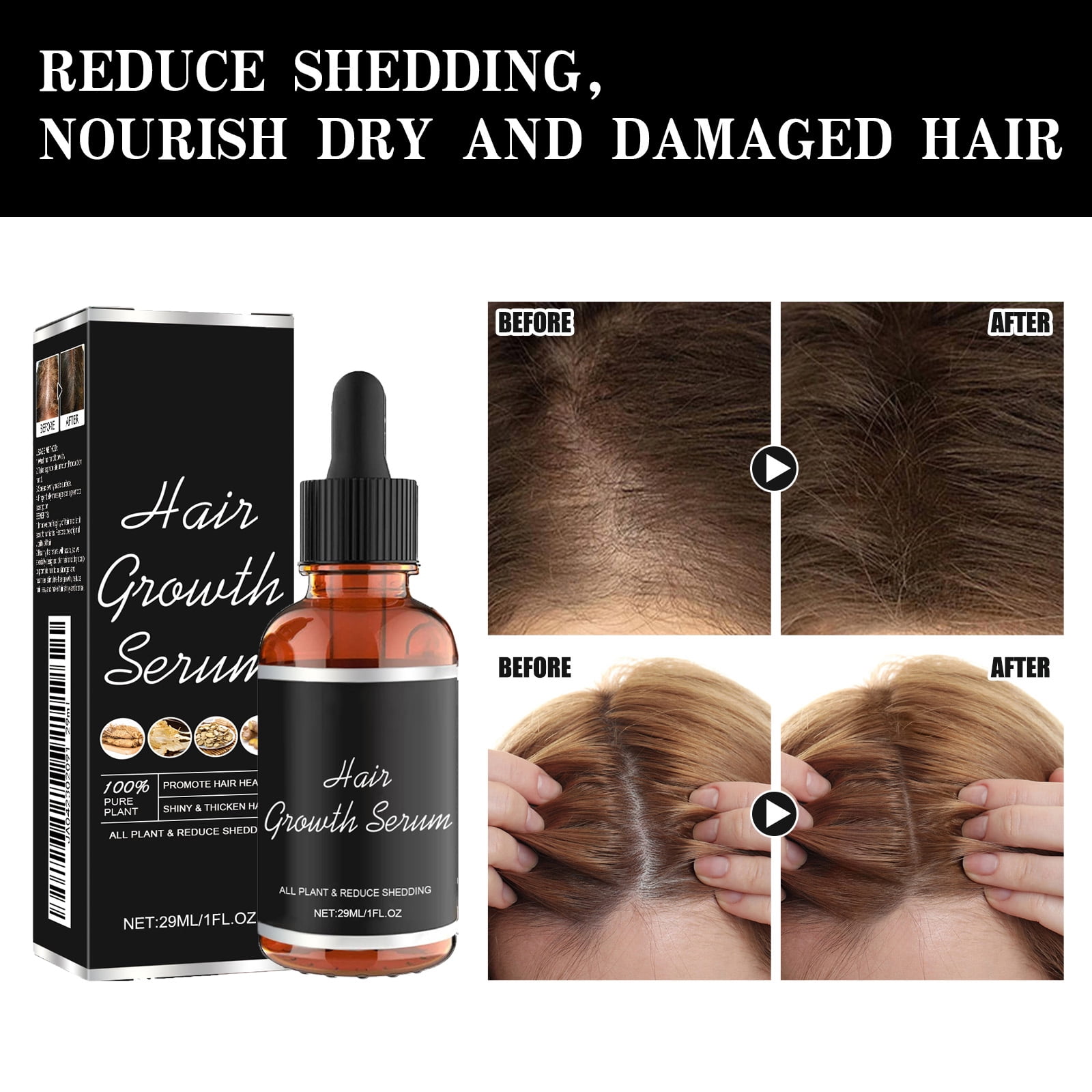Alvantor Hair Growth and Scalp Nourishment Serum for Damaged Hair, 1 fl oz