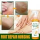thumbnail image 2 of 3pcs 100ml Foot Peeling Spray Natural Orange Essence Pedicure Foot Hand Dead Skin Exfoliator Whiten Foot Care Spray, 2 of 5