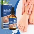 thumbnail image 4 of Aceite nutritivo para el cuidado de las uñas. Hidrata y repara las uñas de manos y pies. Limpia las uñas suaves, fortalece las cutículas y da brillo. Líquido para el cuidado de las uñas 30 ml. Agua es, 4 of 9