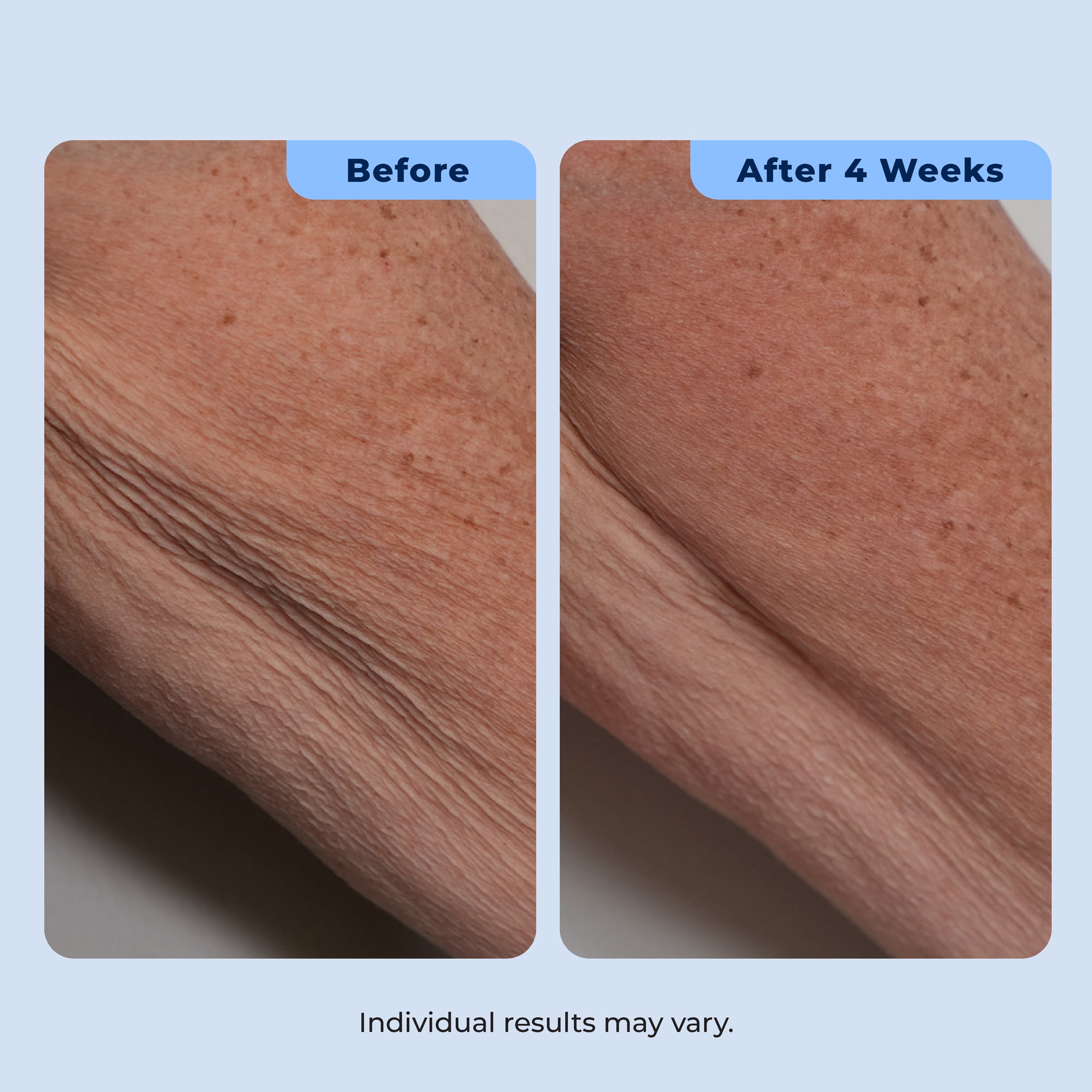 Plexaderm Dual Action Repair Cream for Neck, Chest & Arms – Firming Cream with Retinol & Bakuchiol for Crepey Skin, Fine Lines & Wrinkles