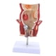 thumbnail image 5 of Modelo rectal de patología humana, herramienta de visualización educativa científica, herramienta intuitiva y didáctica, modelo anatómico para, 5 of 9