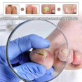 thumbnail image 2 of 30ml X3 Toenail Repair Liquid Soft Nail Repair Liquid Cleaning Repa, 2 of 3