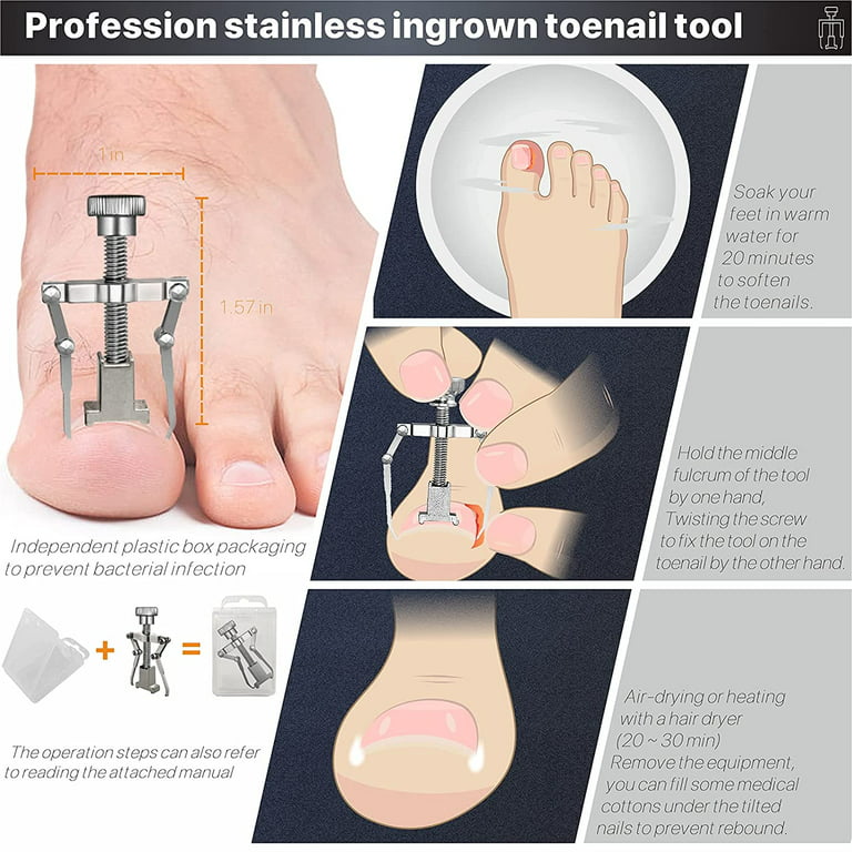 Toenail Clippers for Thick Toenails or Ingrown Toe Nails – Space Saving For  Home