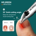 thumbnail image 3 of MR.GREEN Nail Clippers Toenail Cutters Anti-Splash Professional Ingrown Thick Hard Nail Scissors Pedicure Tools Manicure Sets (Blue Handle), 3 of 6