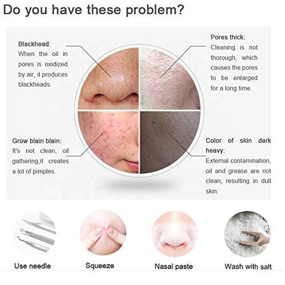 Microcrystaline Blackhead Remover